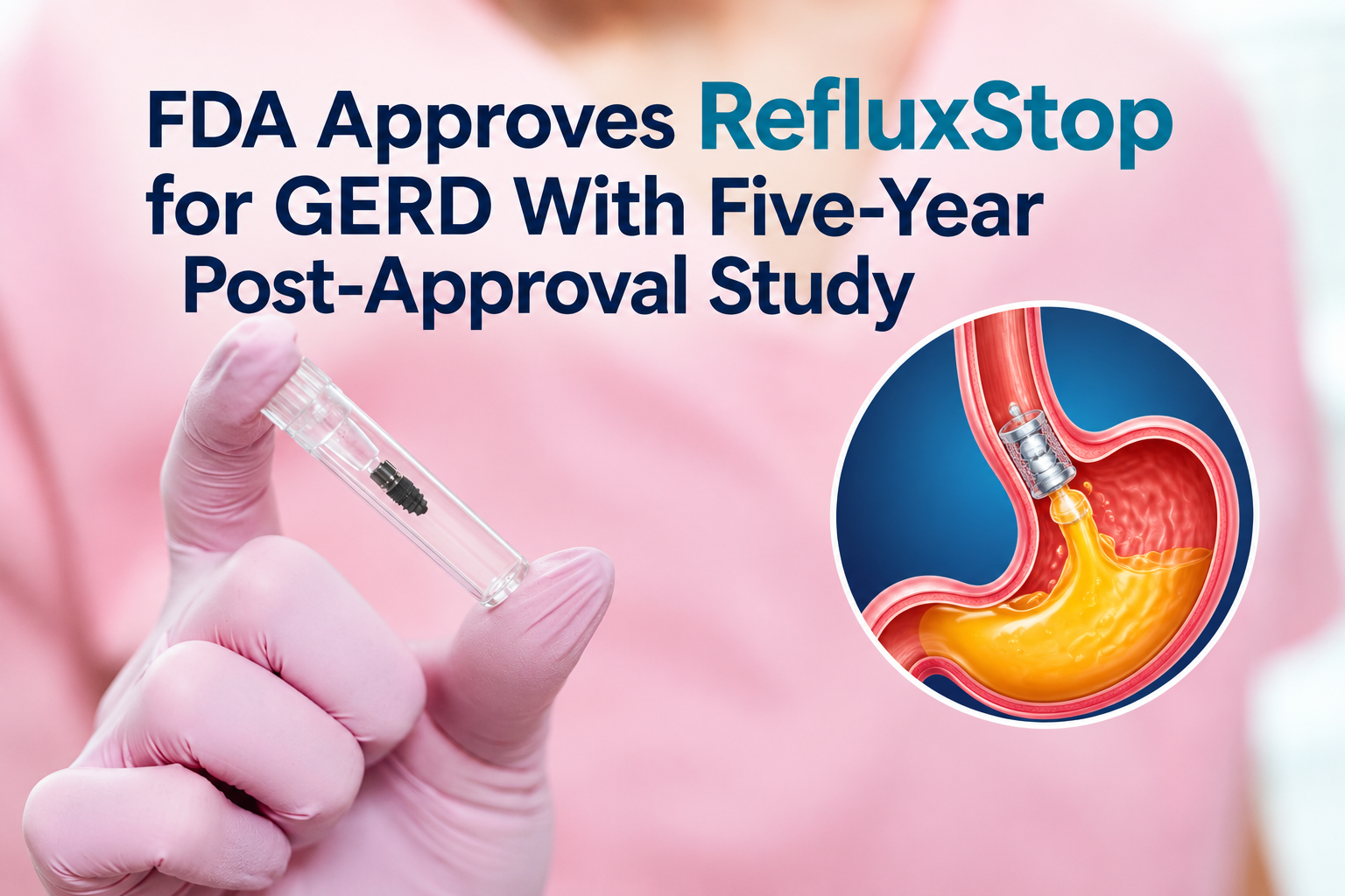 A reflux implant package beside a five-year follow-up calendar and clinical notes.