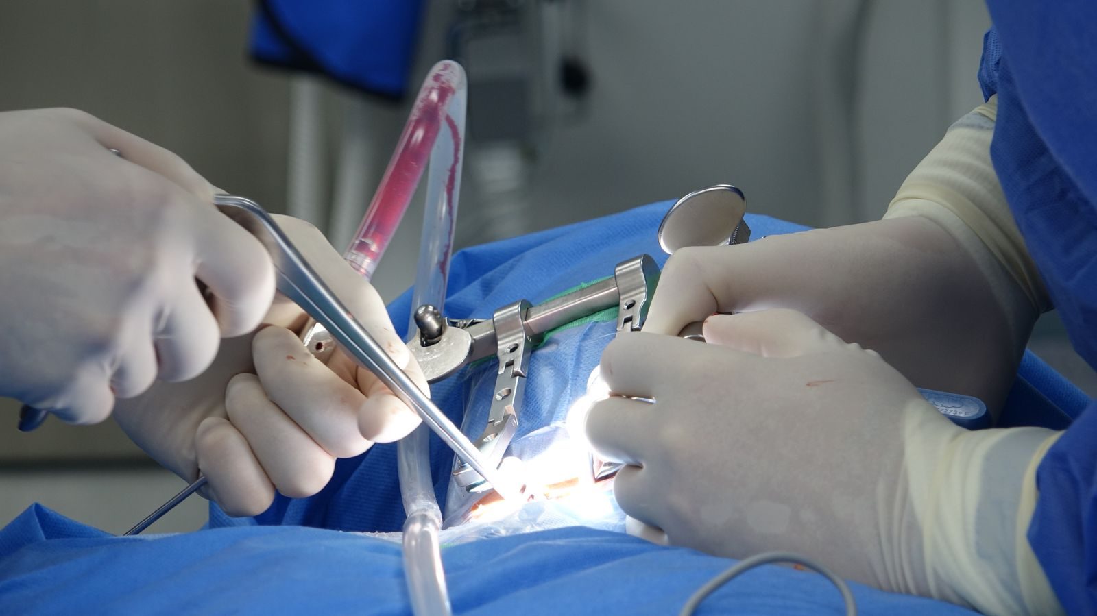 Surgeons in an operating room performing spinal surgery with precise tools and sterile equipment.