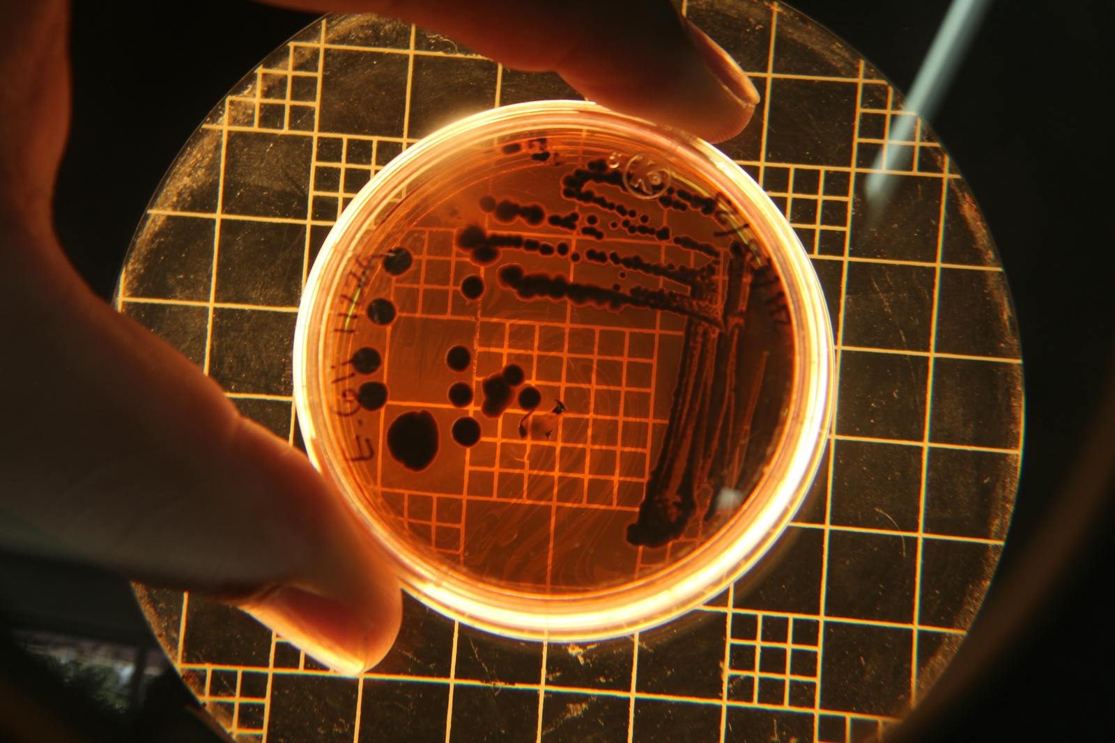 Close-up of bacterial colonies in a Petri dish under a microscope in a lab setting.