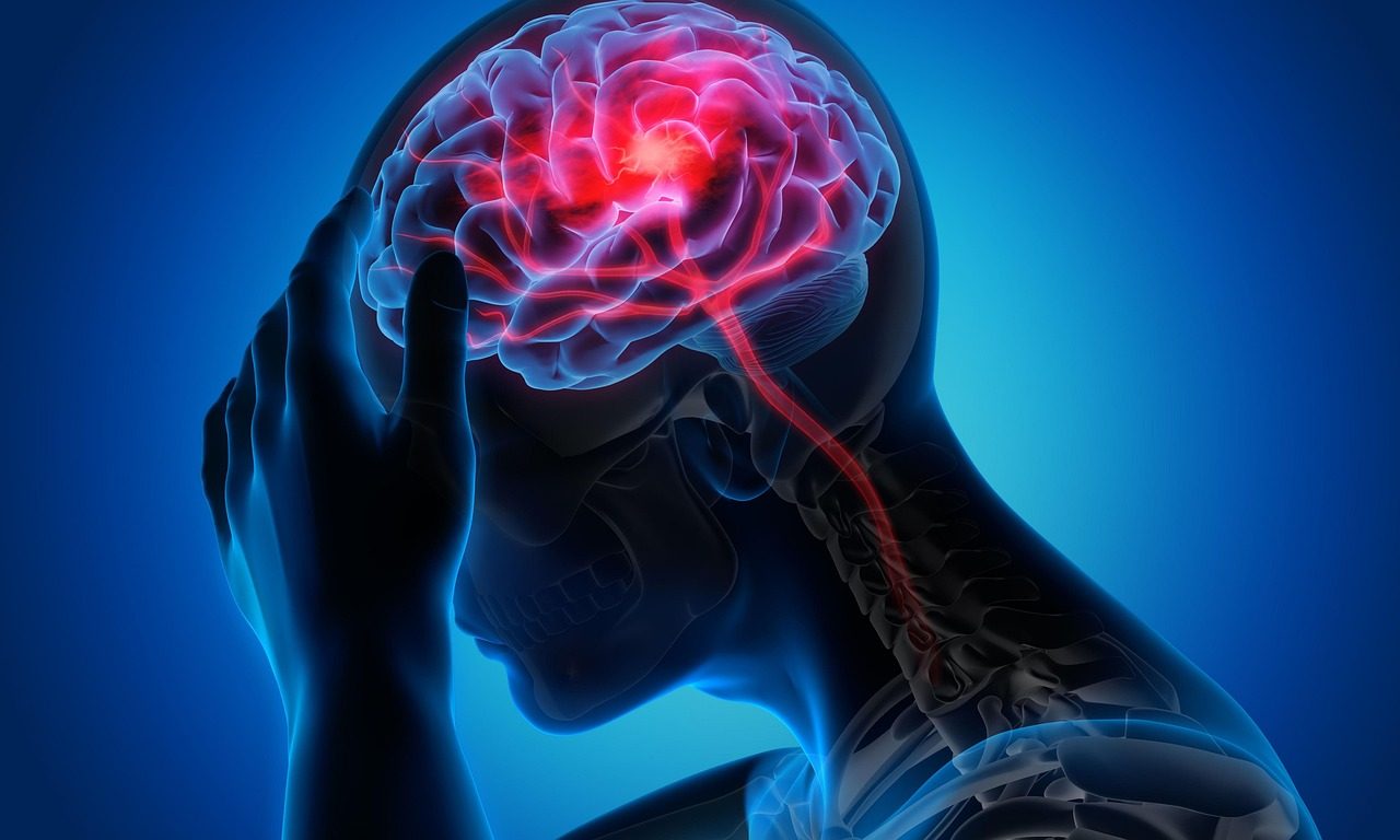 man, woman, migraine, healthcare, health, migraine, migraine, migraine, migraine, migraine
