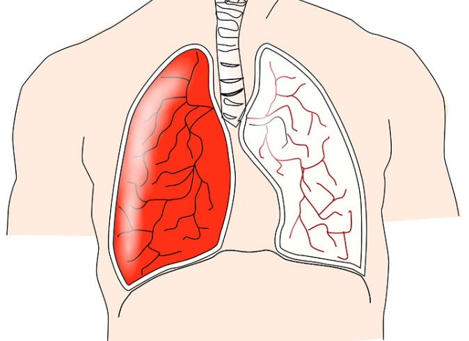 human, respiratory, lungs, anatomy, medical, health, organ, biology, chest, bronchi, disease, healthcare, anatomical, pulmonary, larynx, bronchus, thorax, biological, torso, breathe, medicine, science, respiratory, respiratory, respiratory, lungs, lungs, lungs, pulmonary, larynx, larynx, larynx, larynx, larynx, torso